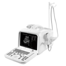 Digital Ultrasound Diagnostic System